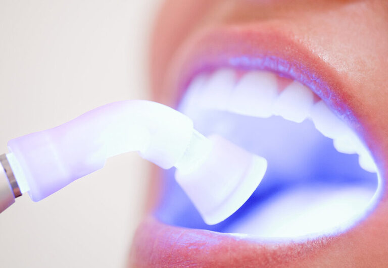 A dentist uses a soft tissue laser